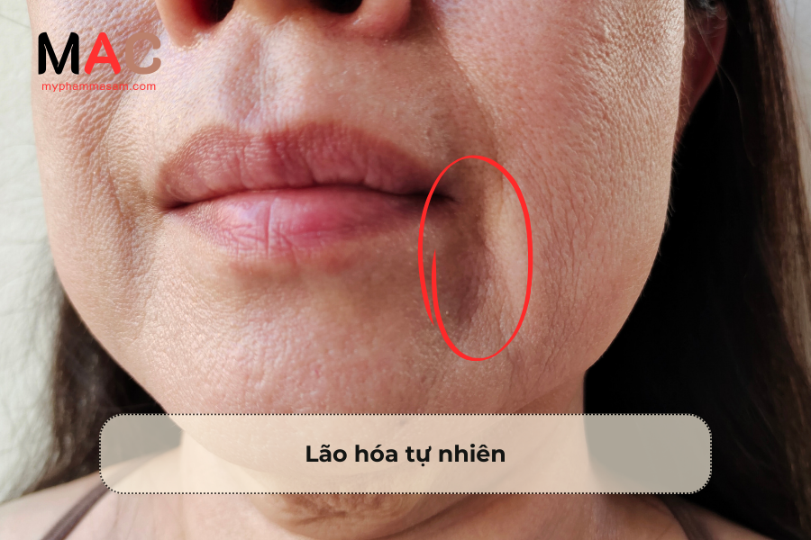 Lão hóa tự nhiên